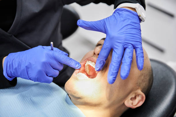 Best Emergency Dental Care for Broken or Chipped Teeth in Hawaiian Gardens, CA